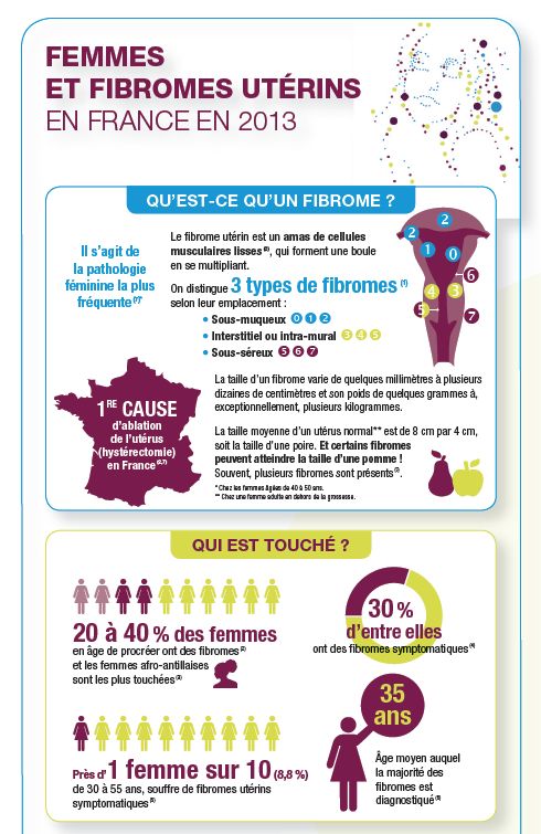 You are currently viewing Près d’1 femme sur 10 souffre de fibromes utérins